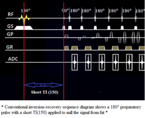 Stir Mri Sequence Physics Pathology And Image Appearance