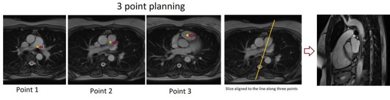 Cardiac Mri Protocols Planning And Techniques Positioning For