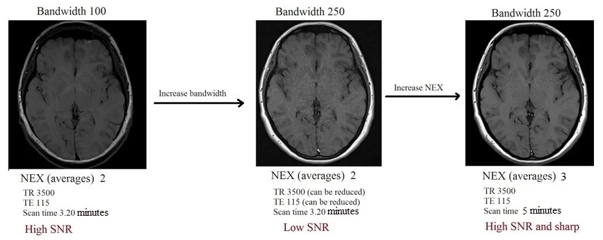 Bandwidth and NEX in MRI