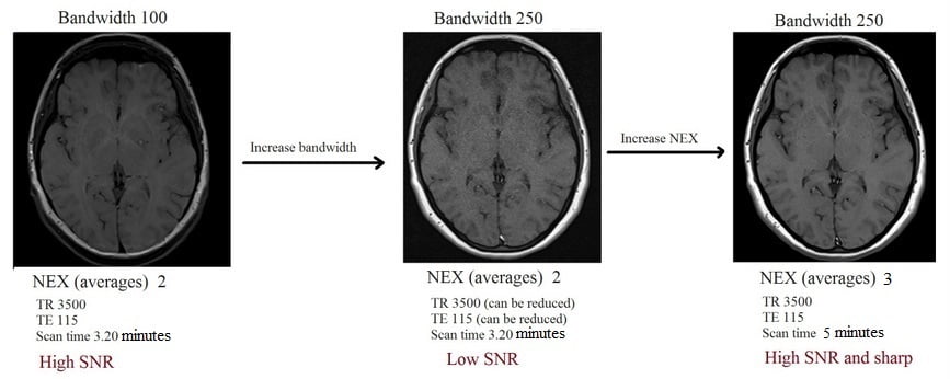 Narrow bandwidth - Questions and Answers ​in MRI