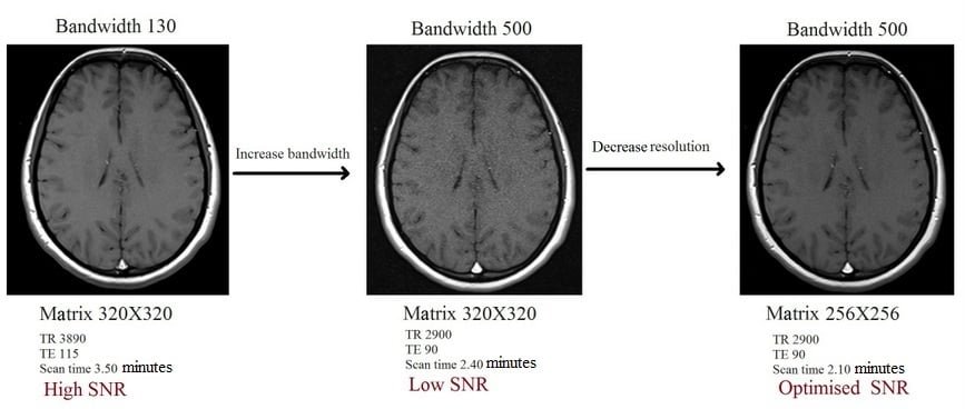 Bandwidth and Resolution in MRI