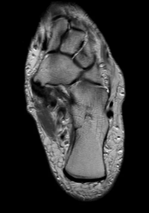 PD Axial sequence used in ankle imaging