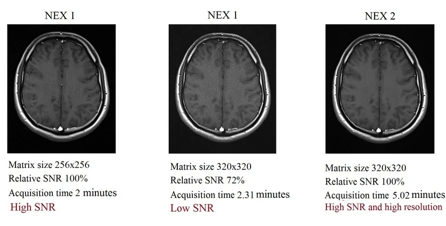 Relation between NEX, SNR and resolution (matrix size) in MRI