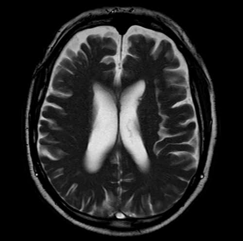True FISP/FIESTA - Questions and Answers ​in MRI