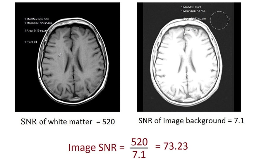 Ultra-High Field Neuro MRI, Volume 10 - 1st Edition