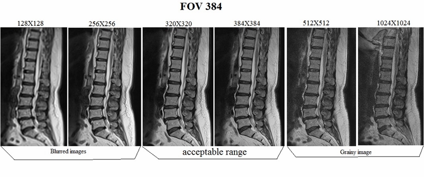 MRI resolution and image quality | How to manipulate mri scan parameters