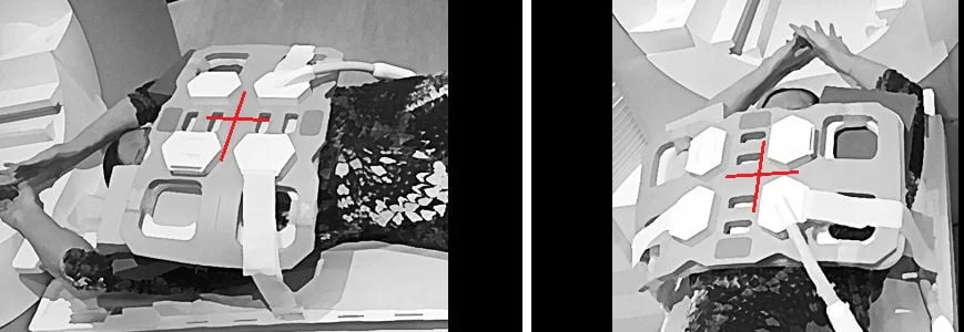 MRA subclavian positioning arm up - MRI