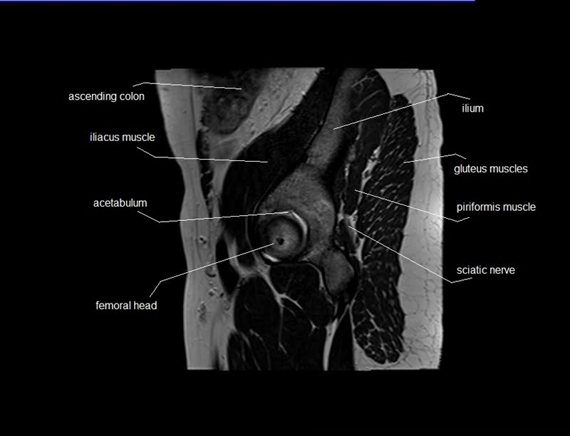 mri sagittal cross sectional anatomy male pelvis image 1