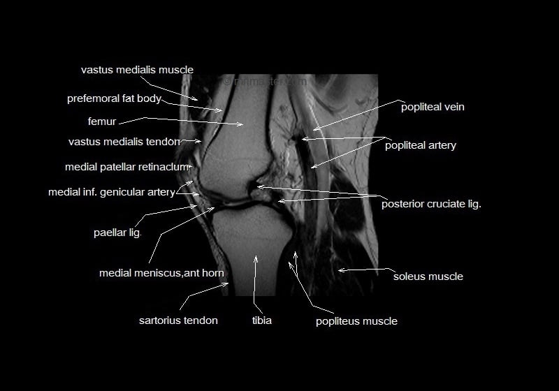 mri knee cross sectional anatomy sagittal image 10