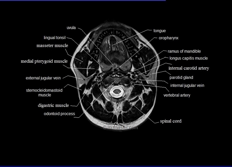 mri neck axial cross sectional anatomy image 1