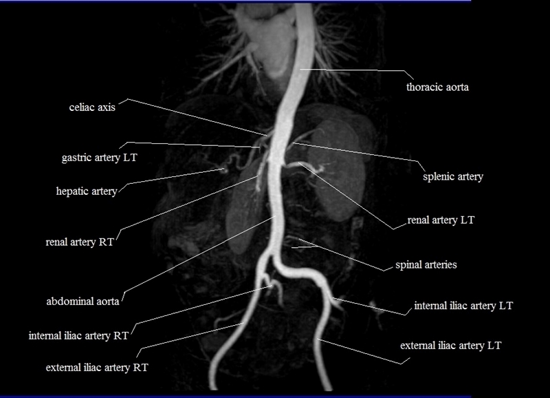 mri arterial cross sectional anatomy of abdomen image 2