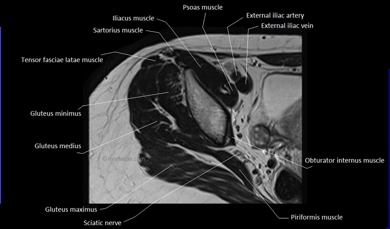 mri axial cross sectional anatomy hip 3