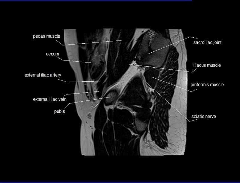 mri sagittal cross sectional anatomy male pelvis image 5