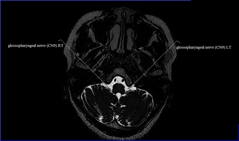 MRI anatomy brain axial image 6