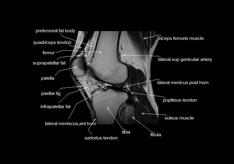 mri knee cross sectional anatomy sagittal image 7