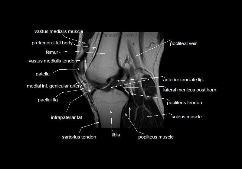 mri knee cross sectional anatomy sagittal image 9