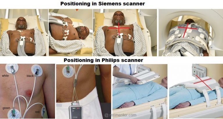 Cardiac MRI protocols, Planning and Techniques | Positioning for ...