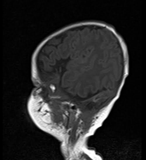 PLAN PED BRAIN T1 Sagittal - Mrimaster