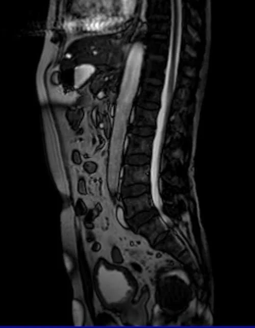 MRI UROGRAPHY LOC 3 - MRI