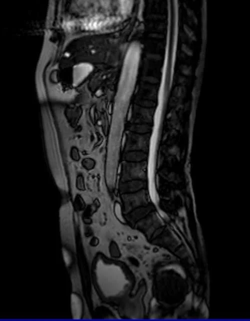 MRI UROGRAPHY LOC 3 - MRI