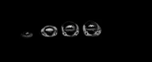 MRI hand axial t1 image 1 - MRI