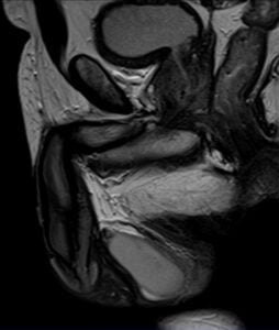 PLAN TESTIS sag t2 hr - mrimaster