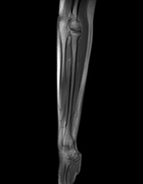 forearm localizer 1 - MRI