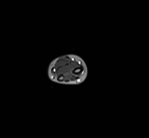 forearm localizer 2 - MRI