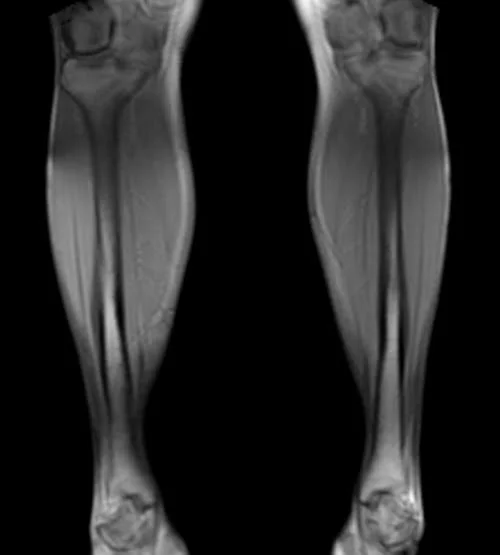 mra legs localizer 1 - MRI