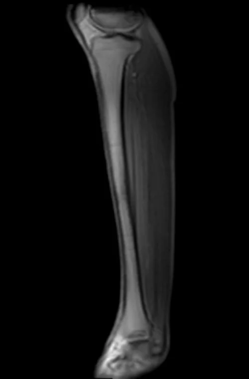 mra legs localizer 2 - MRI