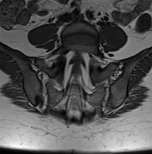 mri coronal t1 sij’s image 3 - MRI