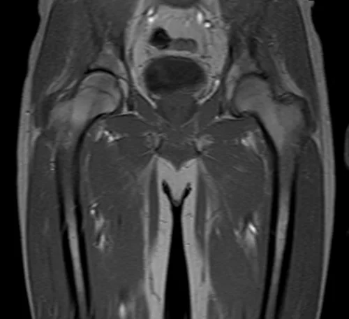 mri hipa localizer 1 - MRI