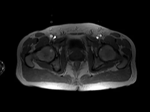 mri hipa localizer 2 - MRI