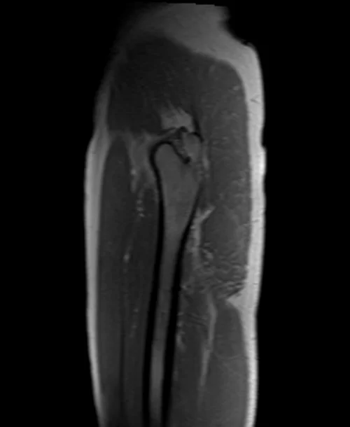 mri hipa localizer 3 - MRI