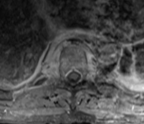 mri lumbar spine post contrast axial image 2 - MRI