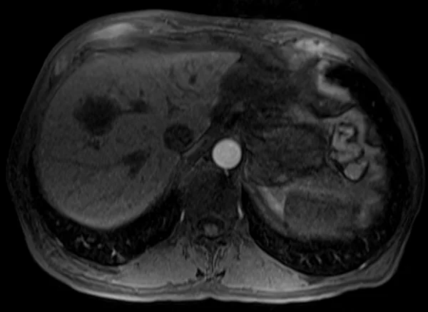 post art t1 2 - MRI