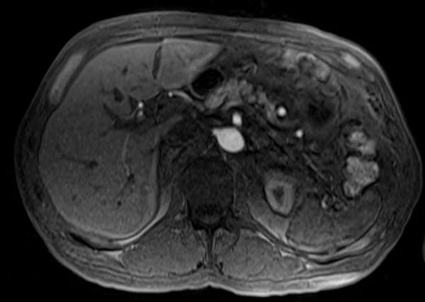 post art t1 3 - MRI