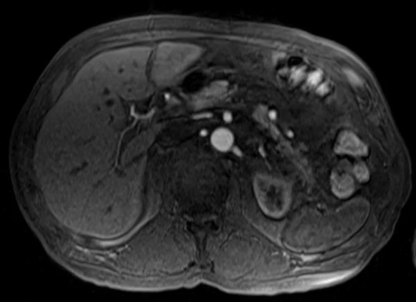 post art t1 4 - MRI
