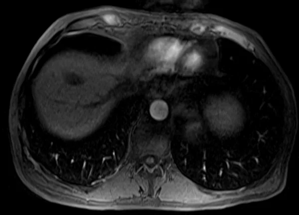 post art t1 - MRI