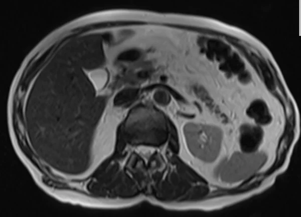 t2 90 4 - MRI