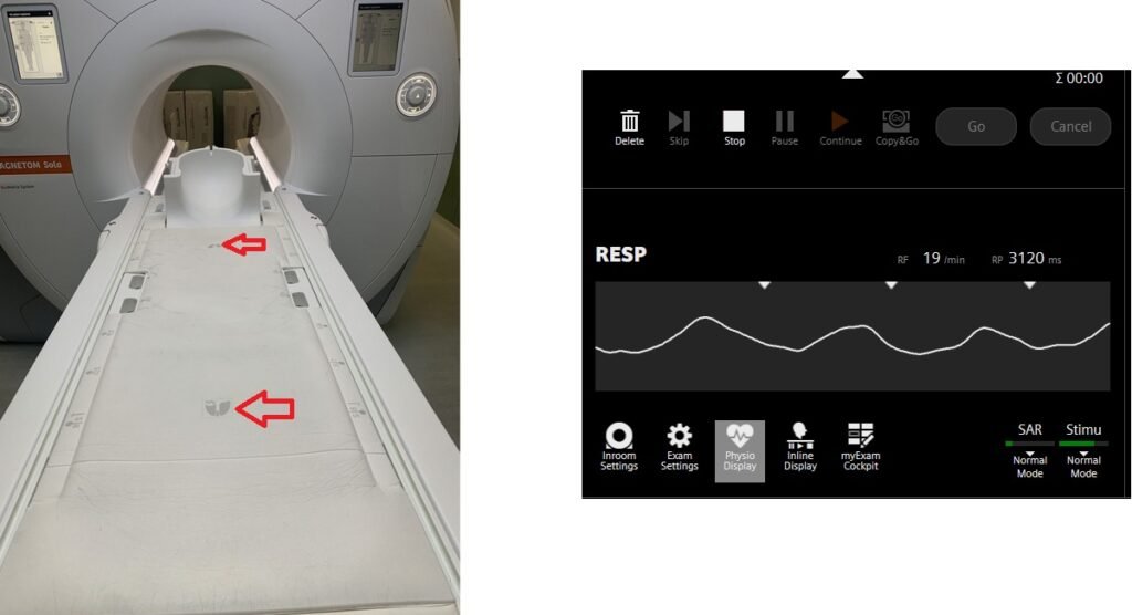 Advanced MRI scanners are equipped with built-in table sensors