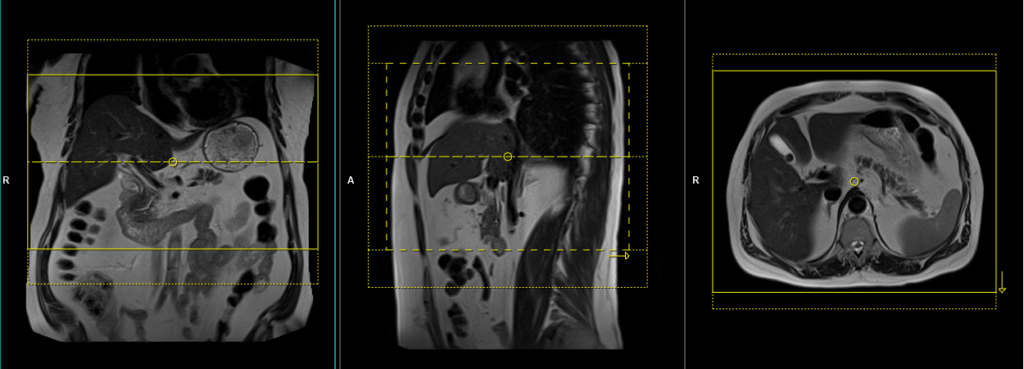 Read Your MRI Basic Education from a World-Renowned Spine Expert |  ChiroGeek.com