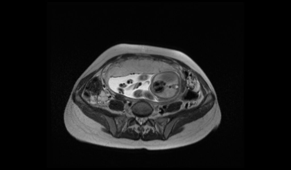 fetal brain mri localiser - mrimaster