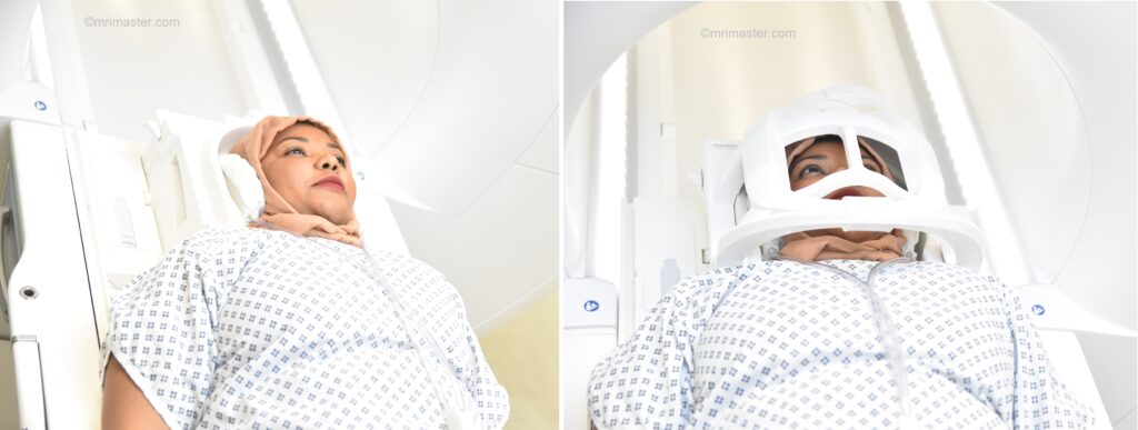 MALIGNANT OTITIS EXTERNA (MOE) or SKULL BASE OSTEOMYELITIS MRI positioning photo