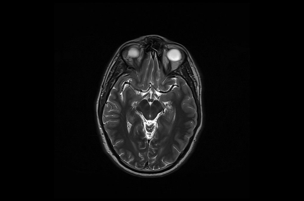 Field of view (FOV) MRI | How to change MRI FOV