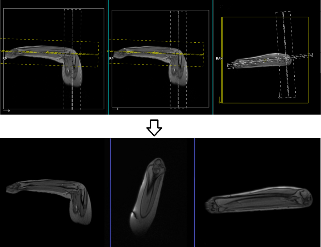 MRI FABS View |FABS View protocol and planning