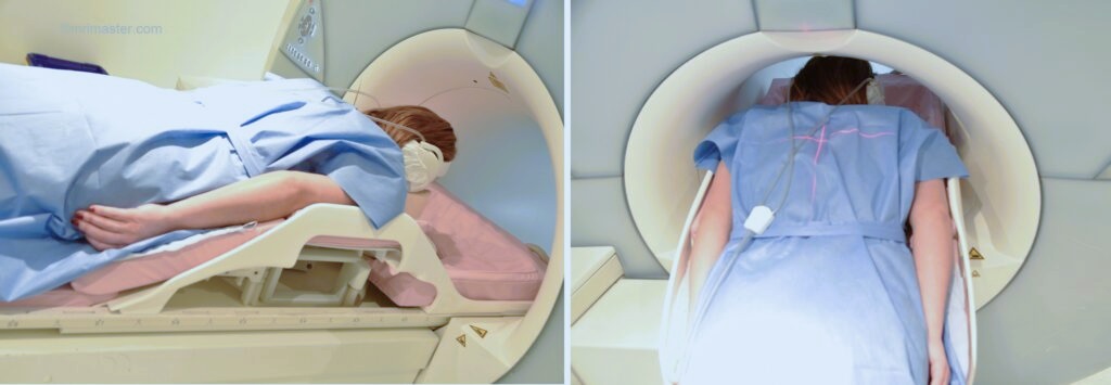 MRI breast implant protocol positioning photo