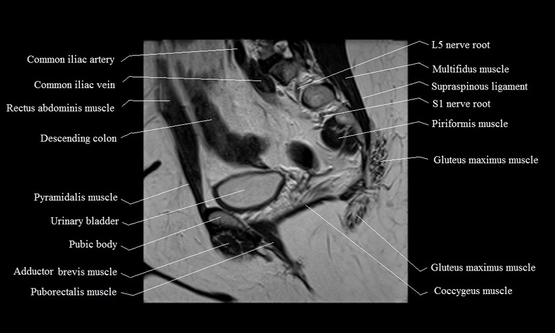 MRI anatomy brain axial image 8