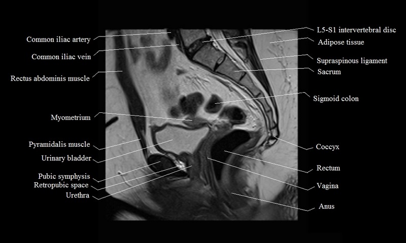 MRI anatomy brain axial image 12