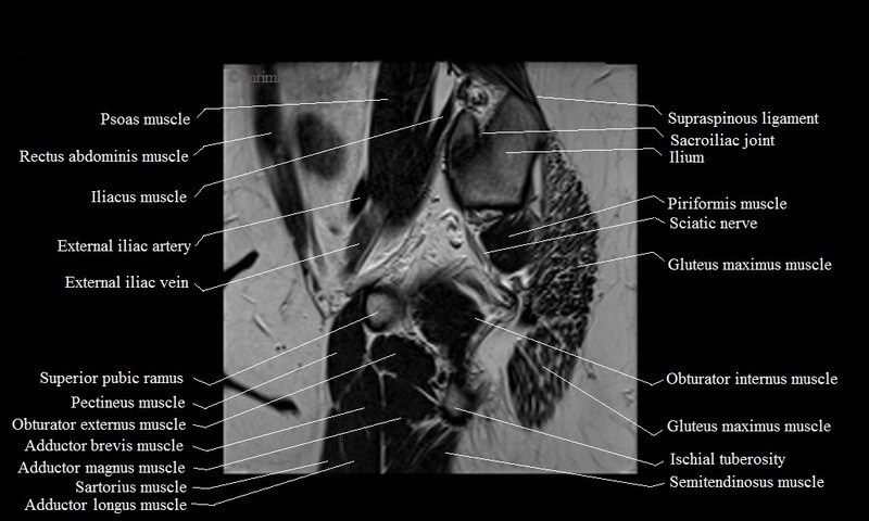 MRI anatomy brain axial image 10